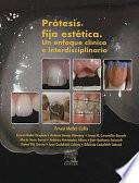 Libro de Prótesis Fija Estética