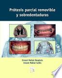 Libro de Prótesis Parcial Removible Y Sobredentaduras