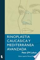 Libro de Rinoplastia Caucásia Y Mediterránea Avanzada
