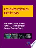Libro de Lesiones Focales Hepáticas