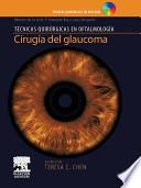 Libro de Cirugía Del Glaucoma + Dvd Rom