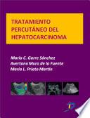 Libro de Tratamiento Percutáneo Del Hepatocarcinoma