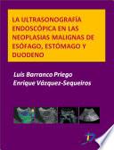 Libro de La Ultrasonografía Endoscópica En Las Neoplasias Malignas De Esófago, Estómago Y Duodeno