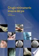 Libro de Cirugía Mínimamente Invasiva Del Pie