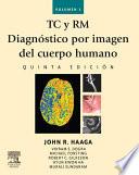 Libro de Tc Y Rm. Diagnóstico Por Imagen Del Cuerpo Humano