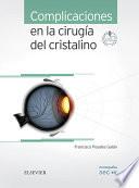 Libro de Complicaciones En La Cirugía Del Cristalino
