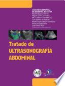 Libro de Tratado De Ultrasonografía Abdominal