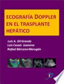 Libro de Ecografía Dopple En El Trasplante Hepático