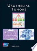 Libro de Urothelial Tumors