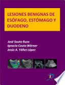 Libro de Lesiones Benignas De Esofágo, Estómago Y Duodeno