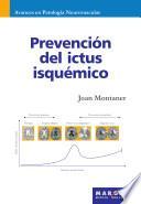 Libro de Prevención Del Ictus Isquémico