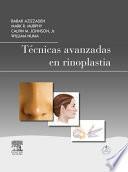 Libro de Técnicas Avanzadas En Rinoplastia + Studentconsult En Español